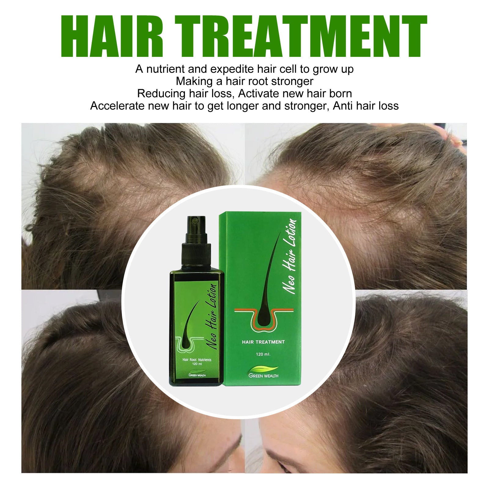Hair Care Growth Lotion Spray Hair Care Growth Lotion Spray